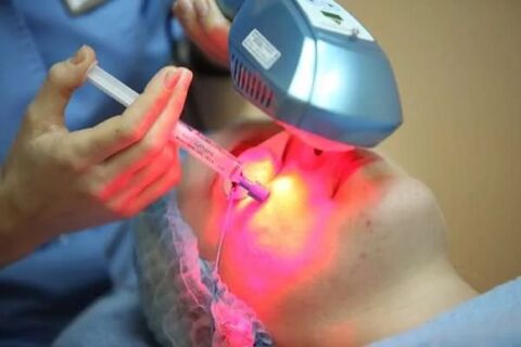 Laser βιοαναζωογόνηση του δέρματος του προσώπου